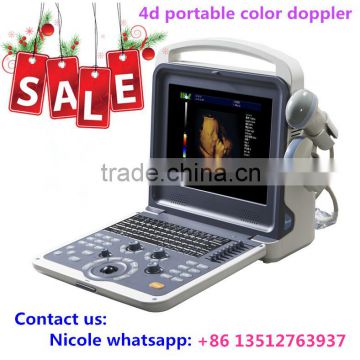 MSLCU28i Cheapest price portable laptop color doppler ultrasound machine 4d image color doppler ultrasound scanner