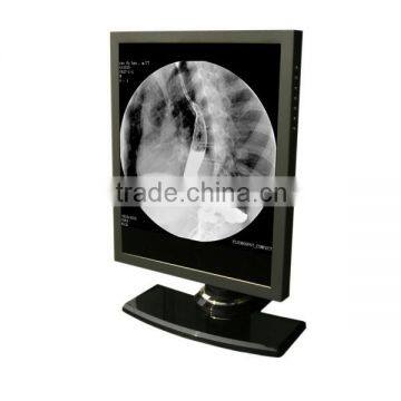 China Hot Sale Wholesale Medical Flatscreen by Factory Directly photo-4