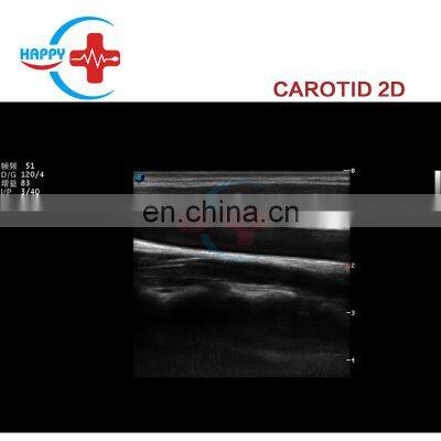 Best Price Sonoscape P9 Digital Color Doppler Ultrasound Trolley Ultrasound Machine/Sonoscape P9