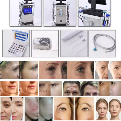 Professional 14 in 1 Aqua Peeling Machine Hydra Oxyge Jet Facial Diamond Dermabrasion Machine Hydro Facials Machine photo-5