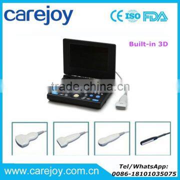 Ultrasonic Laptop type Ultrasound Scanner/machine with Multi-frequency probe with Aluminum box and battery