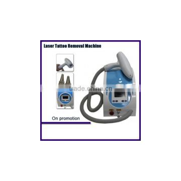 Laser tattoo removal machine with one handle opt shr ipl hair removal machine shr