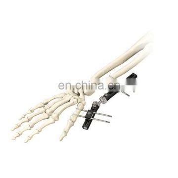 High Quality Wrist Joint External Fixator Orthopedic Surgical Instrument photo-5