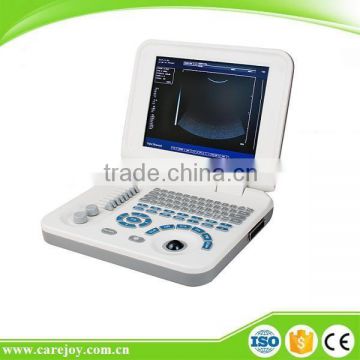 CE&ISO Best Sale B&W Large Screen 10.4 inch Notebook/Laptop Ultrasound Scanner/Machine with Probe and Printer--RUS-9000F2