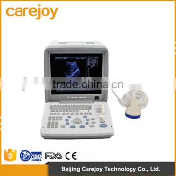 Factory price!CE approved Notebook B-Mode Ultrasound Scanner with 3.5Mhz multi-frequency convex probe RUS-9000B