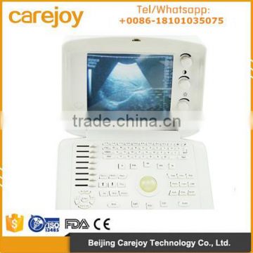 CE Approved Digital Portable Ultrasound Scanner with multi frequency probe machine