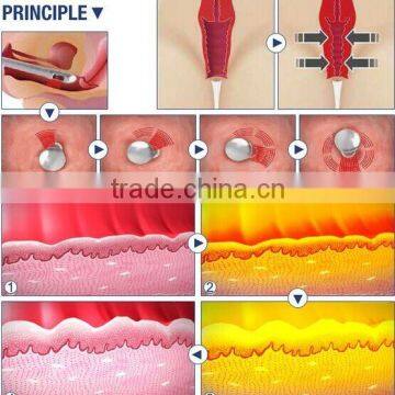 1.0-10mm 2016 Hot Selling Ultrasonic Hifu Vaginal Tightening Machine Skin Tightening photo-5