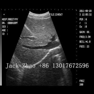 Portable Color Doppler Laptop Ultrasound, Dw-C60 Ultrasonic Machine photo-2