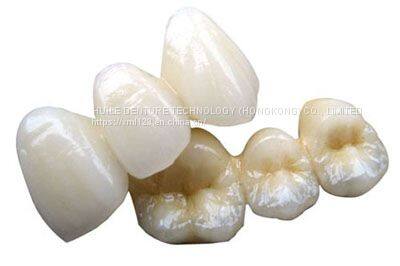 The zirconia crown is white and aesthetic.