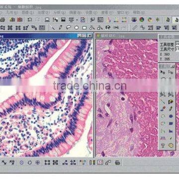 Microscopic ScopeImage Analysis Software digital microscope measure software