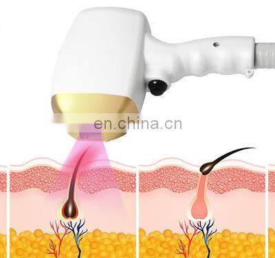 CE Approved Titanium Hair Removal Diode Laser 755nm 808nm1064nm ICE Hair Removal Machine photo-5