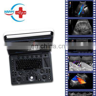 Sonoscape e3 Color Doppler Ultrasound Scanner Price