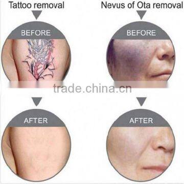 Super Fast Color Touch Screen Logo Customized 10HZ Laser Surgery Tattoo Removal photo-6