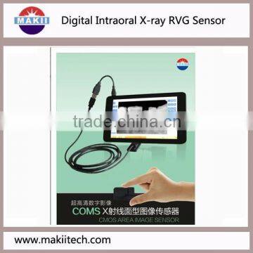 dental digital intraoral cmos sensor