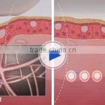 Skin Tightening Vaginal HIFU Machine/Facial Multi-polar RF Lifting Machine/Portable HIFU Machine Face Lifting photo-4