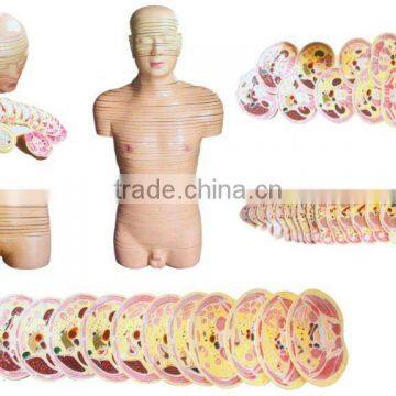 MEDICAL AND TEACHING MODEL-TRANSVERSE PLANE MODEL OF HEAD NECK AND TRUNK LM1308