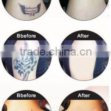 1-10Hz Powerful Big Movable Screen Professional Freckles Removal Machine Active Laser Tattoo Removal Q Switch Laser Tattoo Removal photo-6