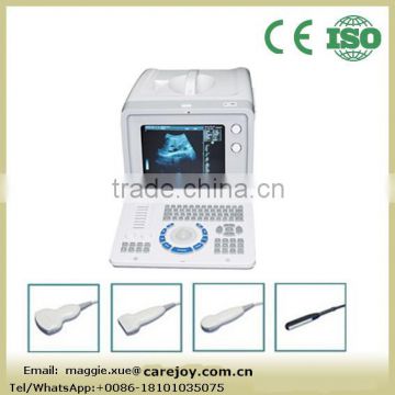 Big sale Portable Ultrasound Scanner Ultrasonic Diagnostic Machine with Convex linear transvaginal rectal Probe optional