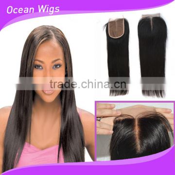 lace front closure