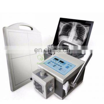 MY-D049V Hospital Device 500mA Digital Mobile Radiography System Medical x Ray Machine Price X-ray Scanner photo-6