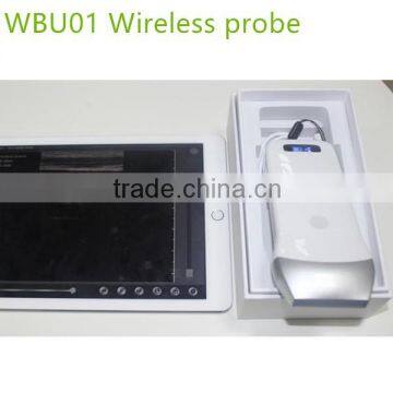 Excellent Portable Wireless Ultrasound Transducers for Sale -WBU01 photo-4