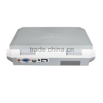 CE Laptop Ultrasound Machine With Multi Frequency Probe Ultrasonic Diagnostic System RUS-9000F2 photo-4