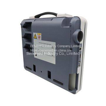 Медицинское оборудование. Ультразвуковой сканер. Чисткое photo-5