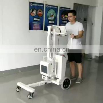 MY-D019E high frequency digital radiography x ray system medical mobile x-ray machine