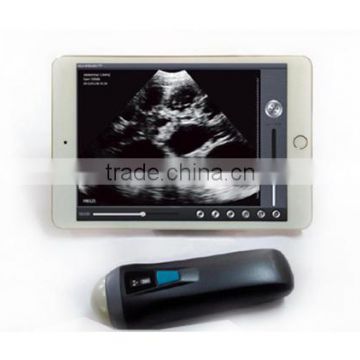 Hanheld Wireless ultrasound working on IPHONE & IPAD (UProbe-1)