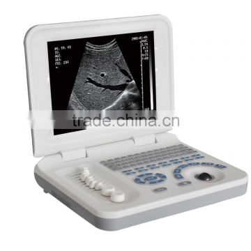 3D Laptop pregnancy scanner /LED display ultrasound for sale