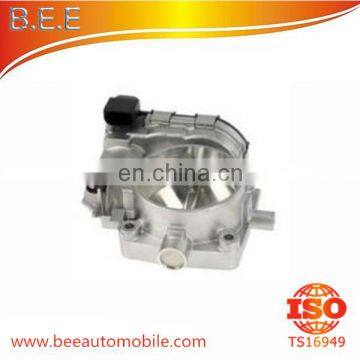 China Manufacturer Performance Throttle Body 0 280 750 017 / A113 141 01 25 For MERCEDES S280;S320;S350;S430 C230;CLK230;SLK230