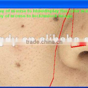 Portable Dialysis Machine/facial Skin Analyzer Machine Skin Scan/skin Analyser for Face photo-6