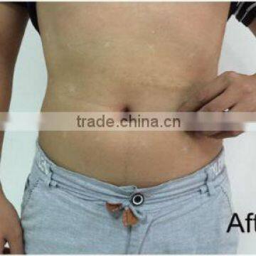 Professional Hifu Ultra Slim Body Shaper photo-2