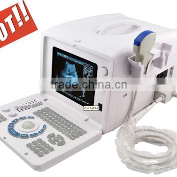 Hot seller Full Digital Portable Ultrasound Scanner RUS-6000D with convex microconvex probe