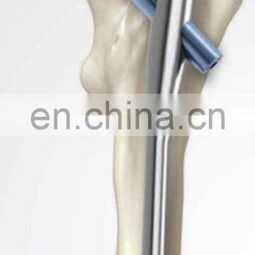 Orthopedic Trauma Implants PFNA photo-6