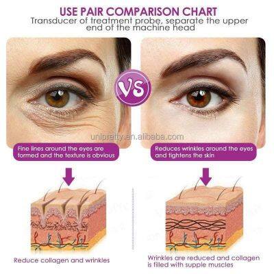 CE EEC FDA 2024 Morpheus 8 Beauty Machine With Ice Hammer photo-3