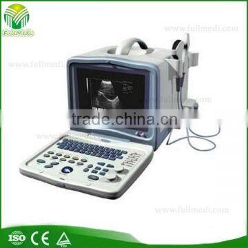 FM-9001 portable ultrasound scanner for human pregnancy