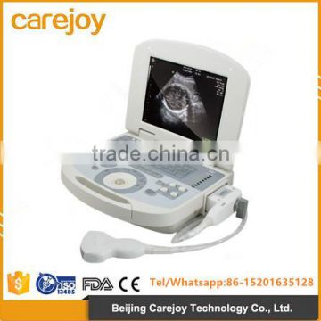 2017 full Digital Portable Ultrasound Scanner forAbdomen, Cardiac, Gynecology, Obstetrics use