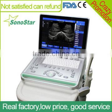 Sonostar 2016 hot supper quality portable ultrasound machine with low price SS-8