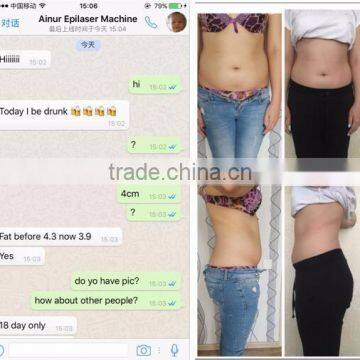 Fat Freezing Hottest Criolipolisis Lipo Cryo Fat Freezing Machine 2 Cryo Handles Cryolipolysis Slimming Machine 50 / 60Hz photo-5