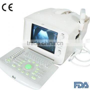 Carejoy FDA CE mark Portable Ultrasound Scanner with Convex linear probe diagnostic pregnancy