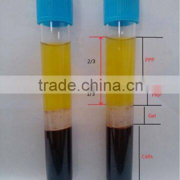 Patent PRP Tube in China photo-2