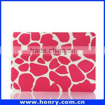 Top Level Cheapest Hard Cover Case for Macbook Air 11 photo-5