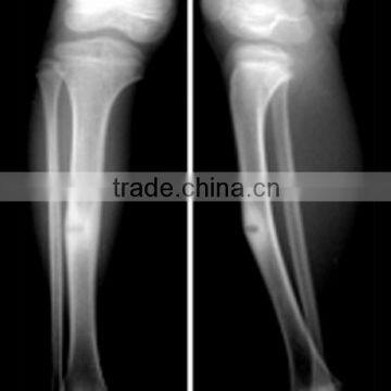 X Ray Processor Film