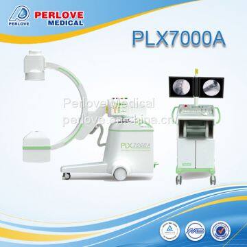 C-arm digital fluoroscopy machine PLX7000A for peripheral angiography