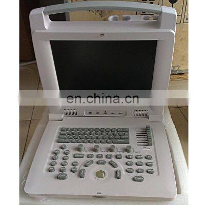 HC-A004 Cheapest Good Quality Medical Full Digital Portable Laptop B/W Ultrasound Scanner for Pregnancy photo-3