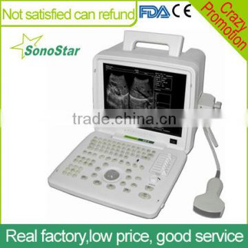 Sonostar high quality portable black and white 12 inches LCD screen ultrasound machine sale SS-4