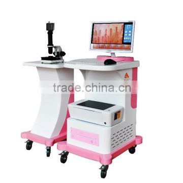 hotsale microcirculation image analyzer from china