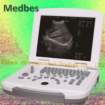 ultrasound scanner with Convex probe or Linear probe