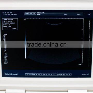 Ultrasonic, Optical, Electronic Equipments Laptop Portable B pc Based Ultrasound Scanner photo-6